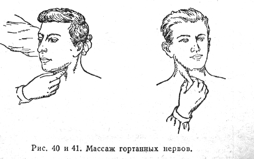 Массаж гортанных нервов